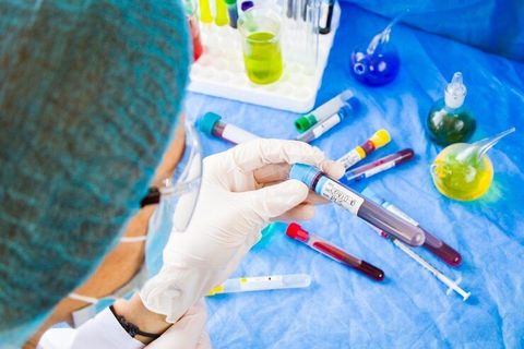 Plasma Dialysis Treatments Explained: Therapeutic Plasma Exchange, Treatment Process and Clinical Applications