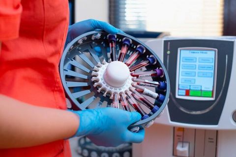 Spin Coating Machines Explained: Spin Coating Technology, Equipment, Processes, Manufacturers and Semiconductor Applications