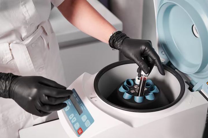 Soxhlet Extraction Systems Explained: Laboratory Technologies and Analytical Applications